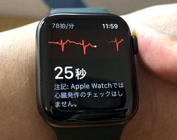 yzApple WatchuSd}v{łցI gЉ