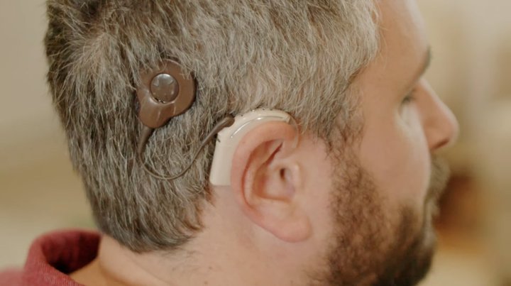 Amazon�AFire TV�̉�����l�H�����ɒ��ڃX�g���[�~���O����Z�p���J���B���o��Q�҂̂��ǂ��G���^���̌��̂���